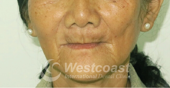 Westcoast International Dental Clinic