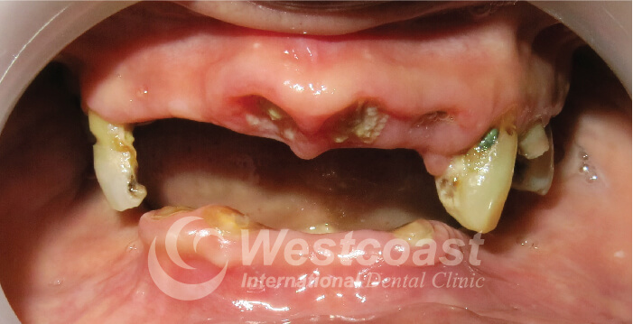 Westcoast International Dental Clinic