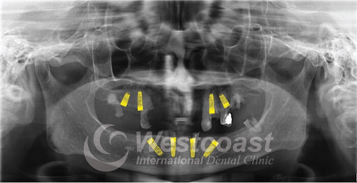 Westcoast International Dental Clinic