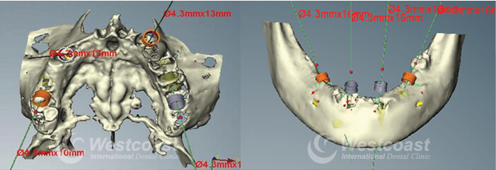 Westcoast International Dental Clinic