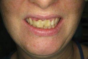 Westcoast International Dental Clinic