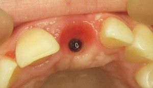 Westcoast International Dental Clinic